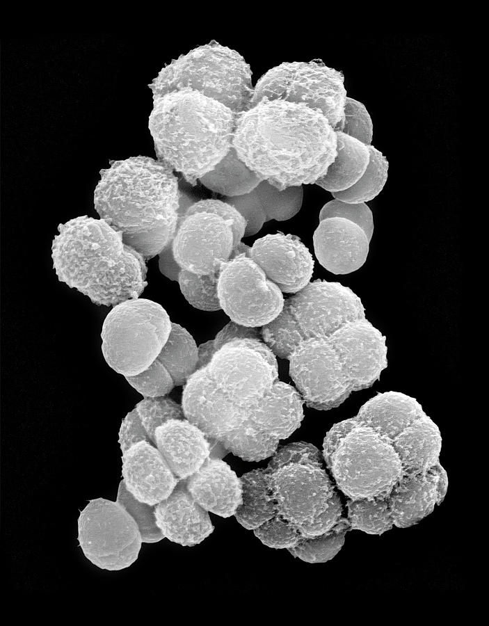 데이노코쿠스 현미경 사진