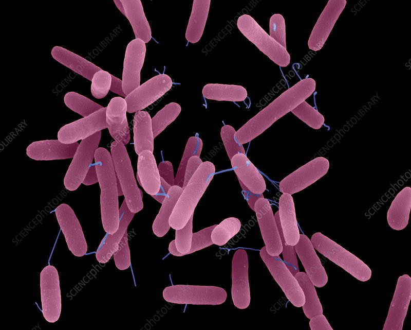 녹농균 현미경 사진